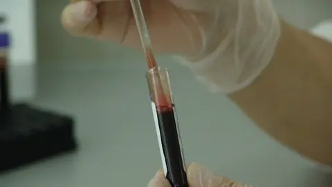 blood-20745_960_720